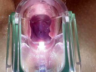 Stella St. Rose - Extreme Gaping, See my Cervix Close-Up using a Speculum 