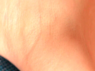 The Skin of My Armpits Is so Delicate