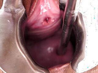 Extreme Cervix Penetration, Sounds, Speculum, Uterus Dilation